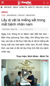 Báo Đồng Nai: Lấy dị vật là miếng sắt trong mắt bệnh nhân nam